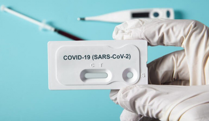 Fotka - Testovanie covid-19 - PCR testy - oznam Okresného úradu Košice okolie